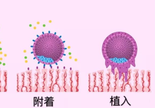 二代试管的优点和缺点？​